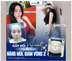 RẠNG RỠ CẢ VISUAL VÀ VÓC DÁNG