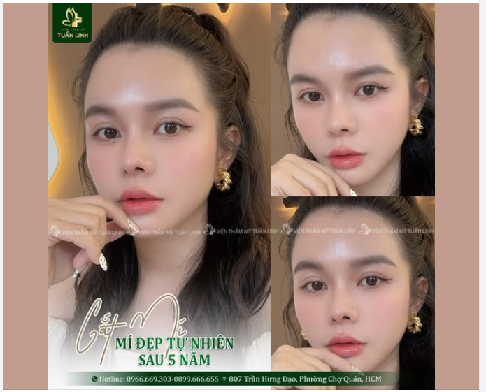 DÁNG MÍ SAU 5 NĂM VẪN ĐẸP TỰ NHIÊN – CÀNG NHÌN CÀNG CUỐN