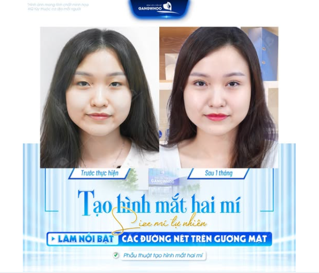 MÍ ĐẸP TỰ NHIÊN - TỰ TIN MẶT MỘC