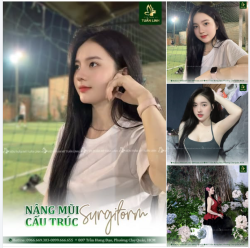 NÂNG MŨI CẤU TRÚC SURGIFORM – DÁNG MŨI ĐẸP TỰ NHIÊN, BỀN VỮNG THEO THỜI GIAN 