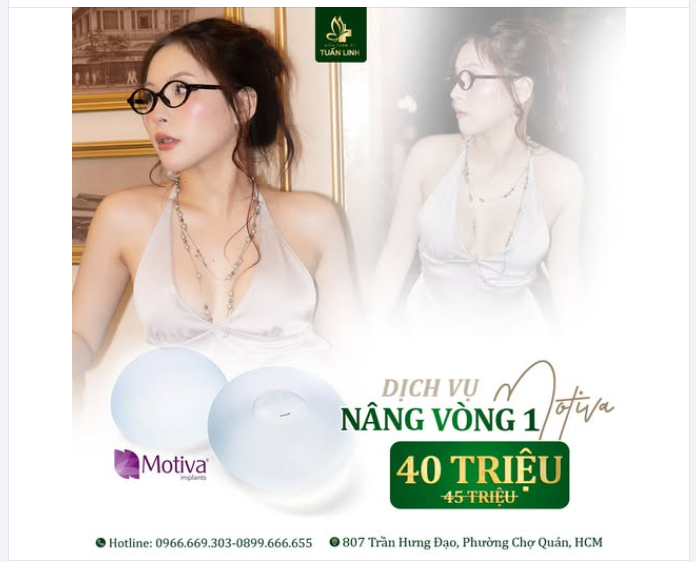 NÂNG VÒNG 1 MOTIVA – ƯU ĐÃI CHỈ CÒN 40TR (GIÁ GỐC 45TR)