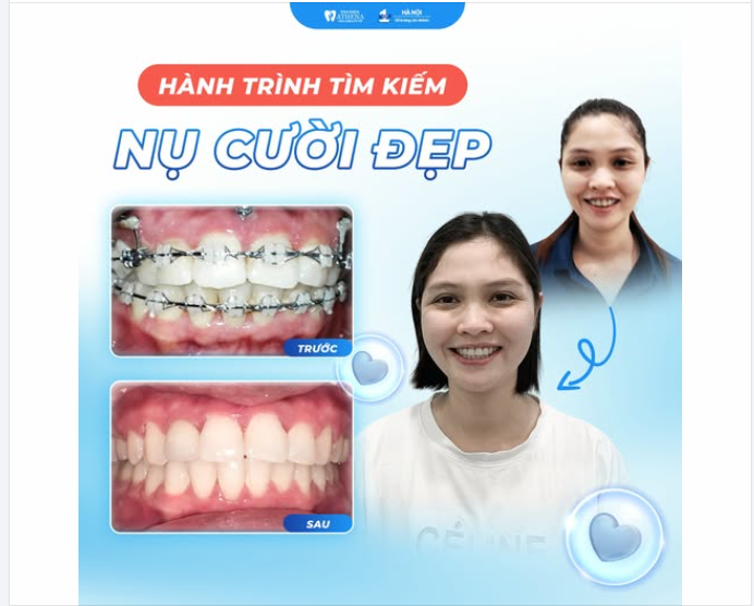 MỖI NỤ CƯỜI ĐẸP ĐỀU BẮT ĐẦU TỪ MỘT HÀNH TRÌNH