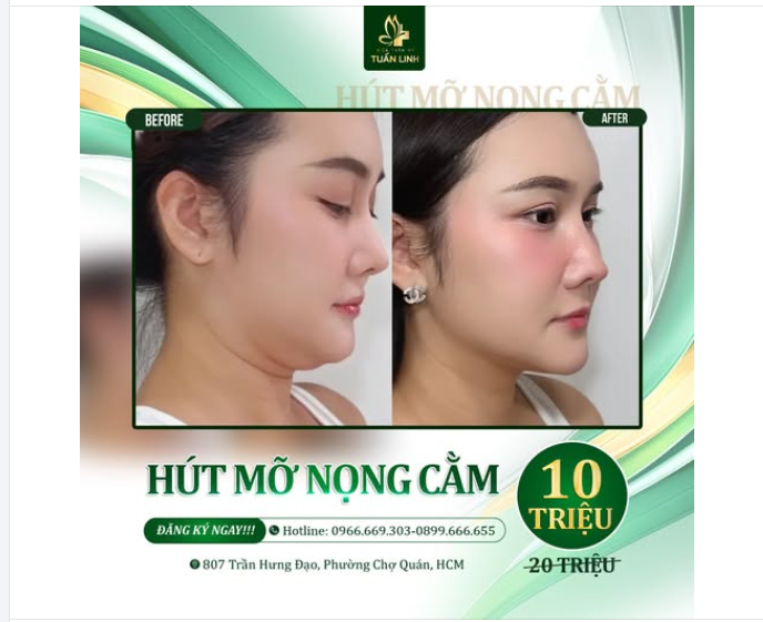 Tết đã đi qua nhưng ''dư âm'' thì vẫn còn...Những chiếc nọng cằm núng nính những bánh chưng, bánh tét đâu rồi ạ!!