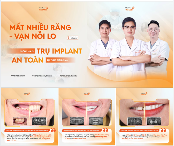 MẤT NHIỀU RĂNG - TẢNG ĐÁ ĐÈ NẶNG TRONG LÒNG