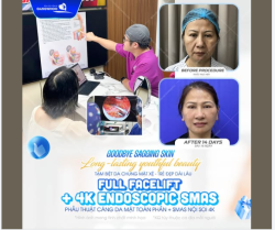 Tại sao làn da chảy xệ, rãnh rồng sâu lại khiến bạn ưu phiền?