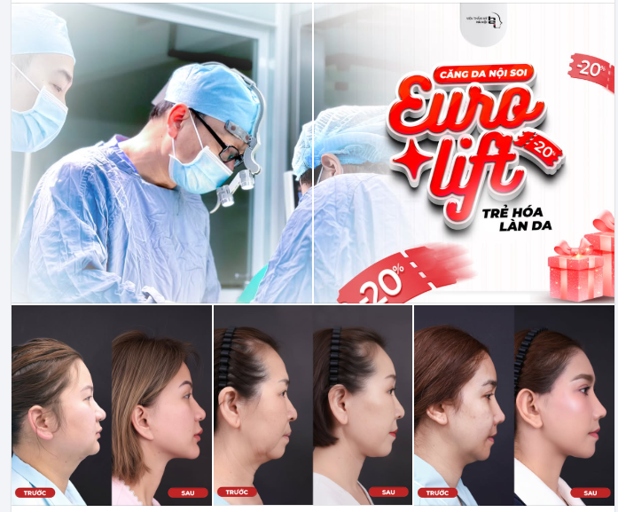 35 MÀ NHÌN NHƯ 53!  Việc gì khó đã có Viện thẩm mỹ Hà Nội lo!