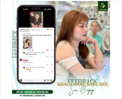 FEEDBACK DÁNG MŨI SAU 1.5 THÁNG - ĐẸP ƯNG Ý!!