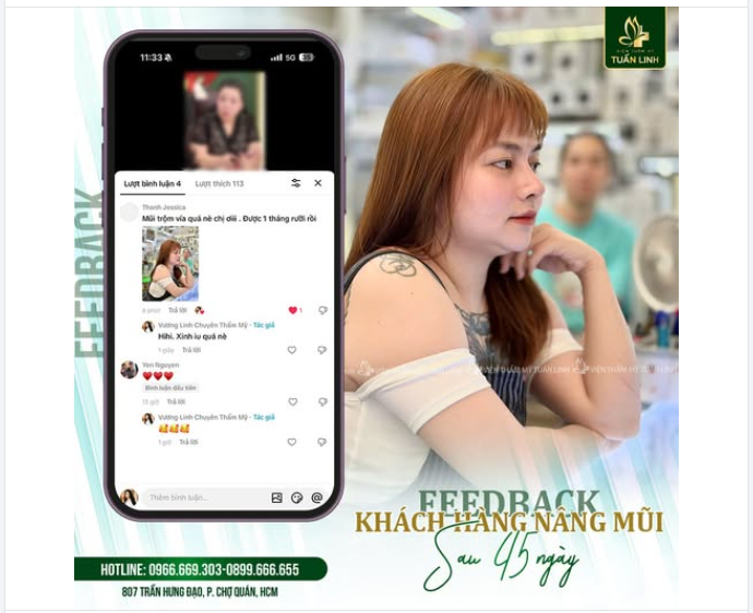 FEEDBACK DÁNG MŨI SAU 1.5 THÁNG - ĐẸP ƯNG Ý!!