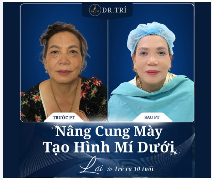KHAI XUÂN NHƯ Ý - ĐỔI MỚI DIỆN MẠO CÙNG DR.TRÍ