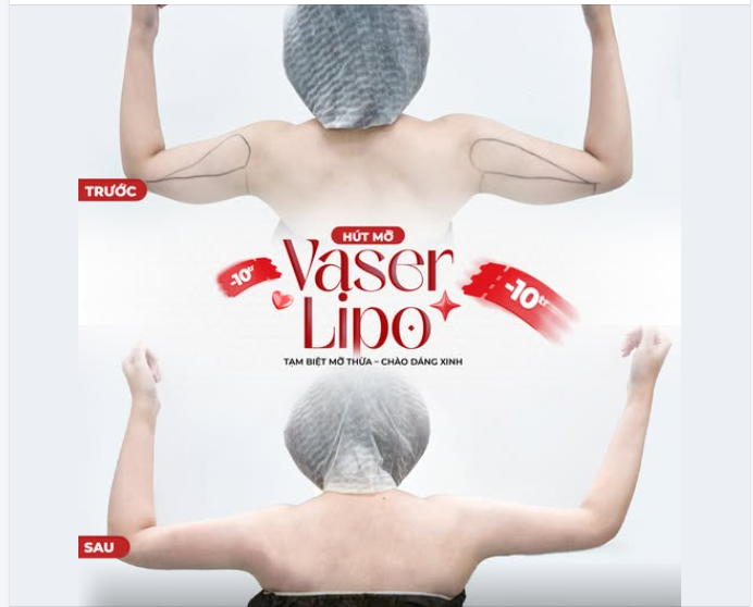 VASER LIPO hoạt động như thế nào?