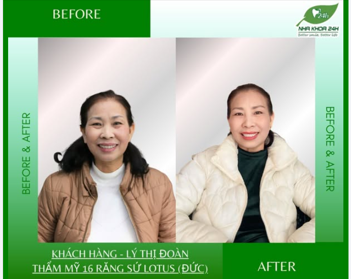 LỘT XÁC NỤ CƯỜI – TỰ TIN RẠNG RỠ MỖI NGÀY