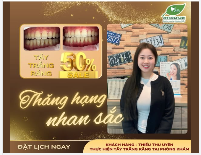 Chỉ 45’ TẨY TRẮNG RĂNG- NÀNG TỰ TIN RẠNG RỠ