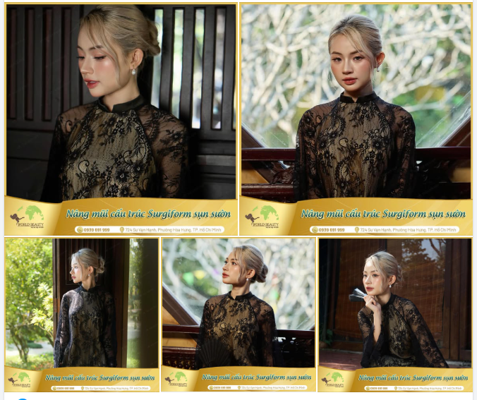 Không ít Quý Cô băn khoăn: Vì sao có người n.âng mũi đẹp bền nhiều năm, nhưng cũng có trường hợp nhanh xuống form, kém tự nhiên?