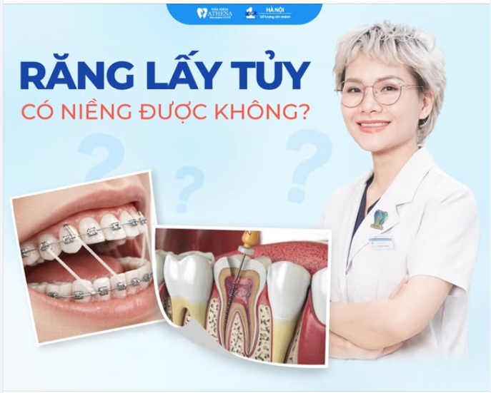 RĂNG ĐÃ LẤY TỦY CÓ NIỀNG ĐƯỢC KHÔNG?
