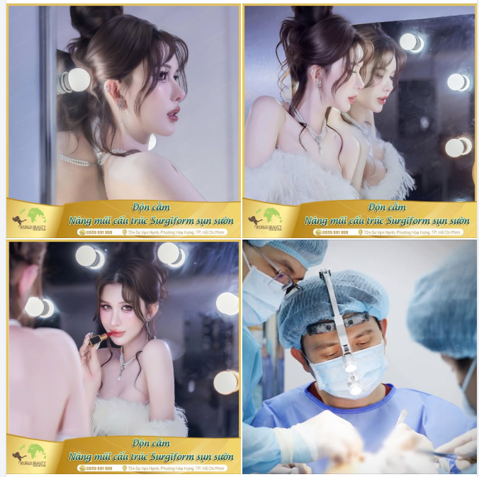 Combo mũi – cằm: Bí quyết nữ tính hoá gương mặt, nâng tầm thần thái Quý Cô