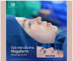 Vừa rời bàn mổ là thấy ngay chiếc mũi "vạn người mê". Một kết quả sửa mũi thực sự không có điểm nào để chê luôn ạ.