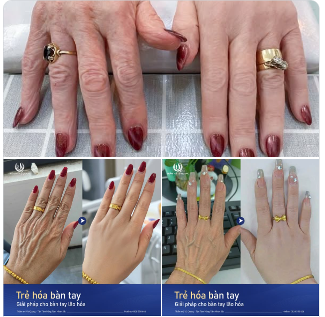 30 PHÚT SỞ HỮU ĐÔI TAY BÚP MĂNG – TỰ TIN DIỆN TRANG SỨC