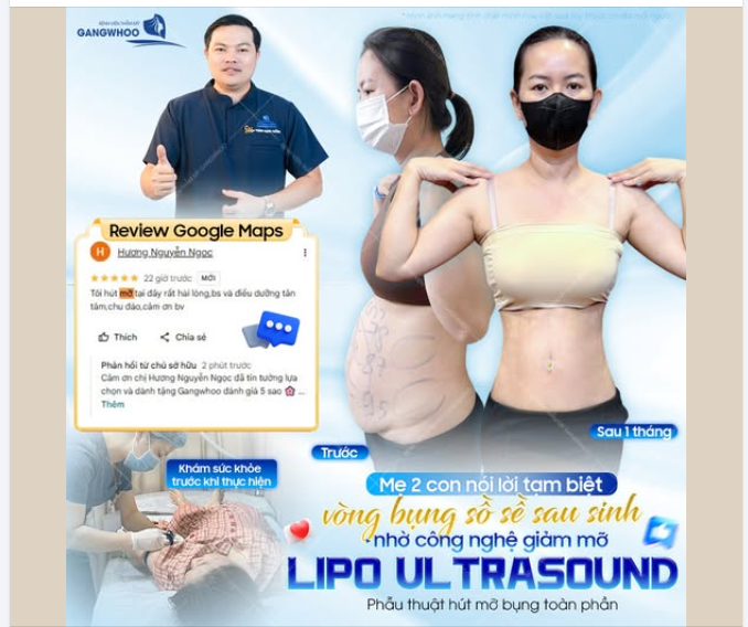 MẸ 2 CON NÓI LỜI TẠM BIỆT VỚI BỤNG SỒ SAU SINH