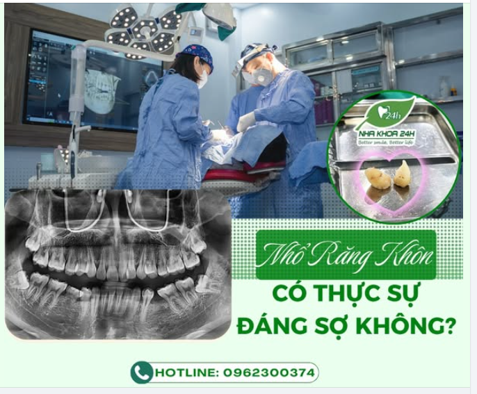 NHỔ RĂNG KHÔN CÓ THẬT SỰ ĐÁNG SỢ?