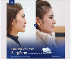TÁI KHÁM SAU 10 NGÀY SỬA MŨI CẤU TRÚC SURGIFORM