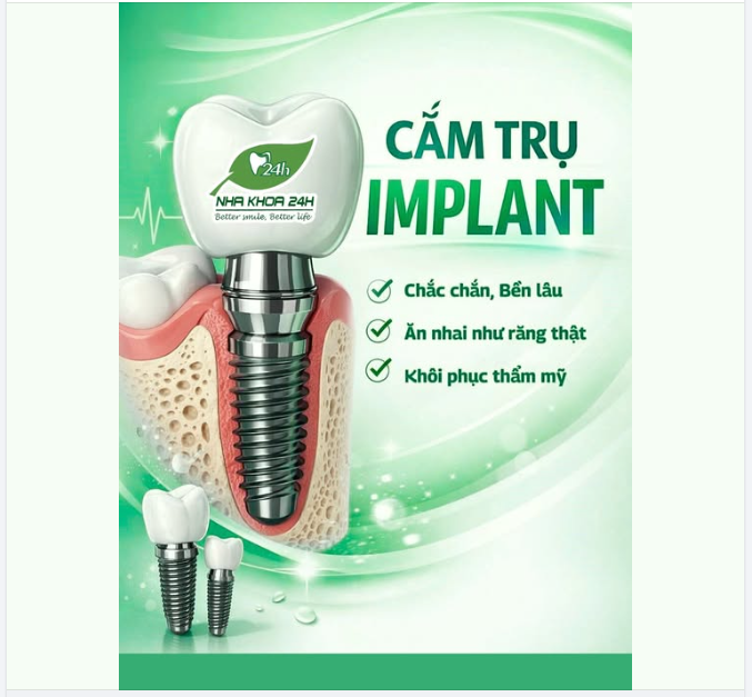 CẤY TRỤ IMPLANT – GIẢI PHÁP PHỤC HỒI RĂNG MẤT HIỆN ĐẠI