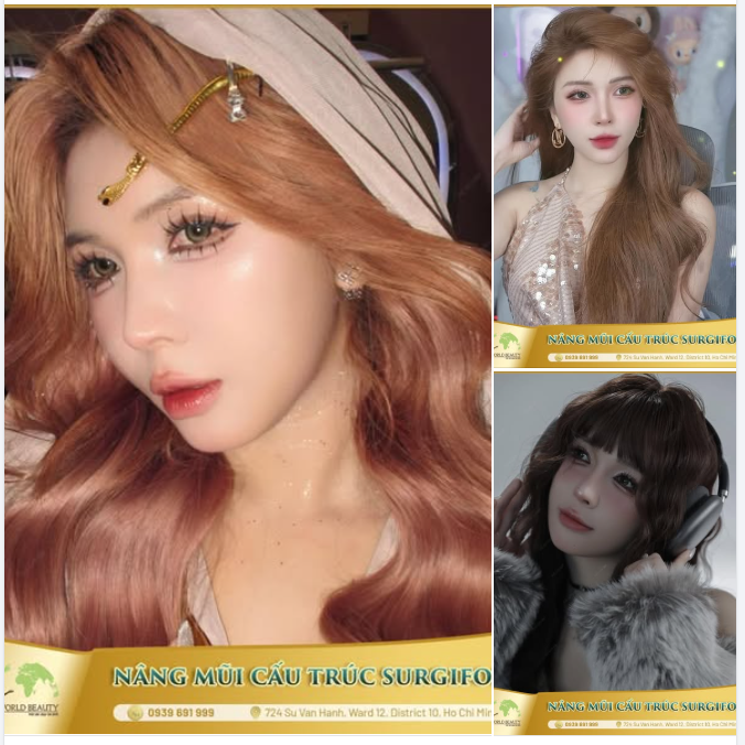 Dáng mũi Barbie-Line sau 4 năm – vẫn giữ nét thanh thoát, hài hòa và đầy cuốn hút!