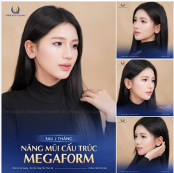 ANH THƯ VÀ MÀN “LỘT XÁC” MÃN NHÃN SAU 2 THÁNG