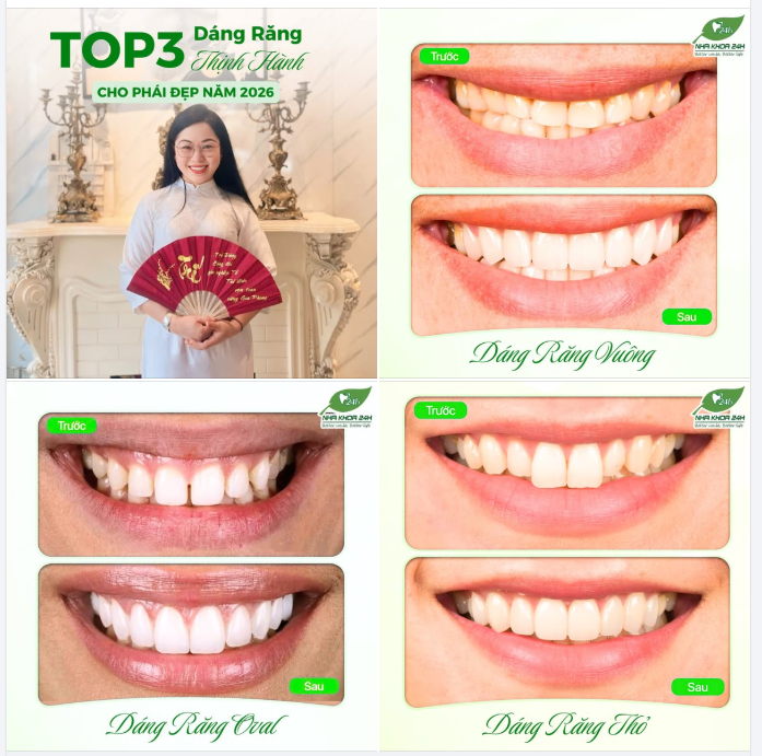 TOP 3 DÁNG RĂNG THỊNH HÀNH CHO PHÁI ĐẸP NĂM 2026