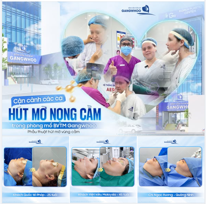 CẬN CẢNH KẾT QUẢ CÁC CA HÚT MỠ NỌNG CẰM TẠI PHÒNG MỔ