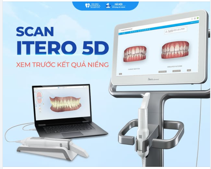 BIẾT TRƯỚC KẾT QUẢ NIỀNG RĂNG – CÓ THẬT KHÔNG?