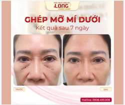 Tại sao người ta không bỏ đi những điều đã cũ, những điều khiến mình không vui để đón nhận những cái mới tươi sáng và tốt đẹp hơn ?