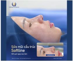 SỬA MŨI HỎNG - KẾT QUẢ "MỸ MÃN" SAU 60 PHÚT!