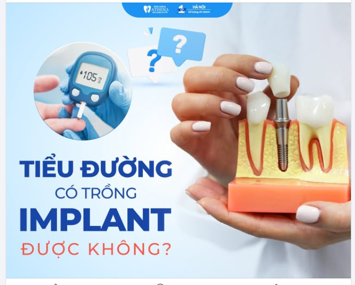 Bệnh tiểu đường không còn là trở ngại khi trồng răng Implant!