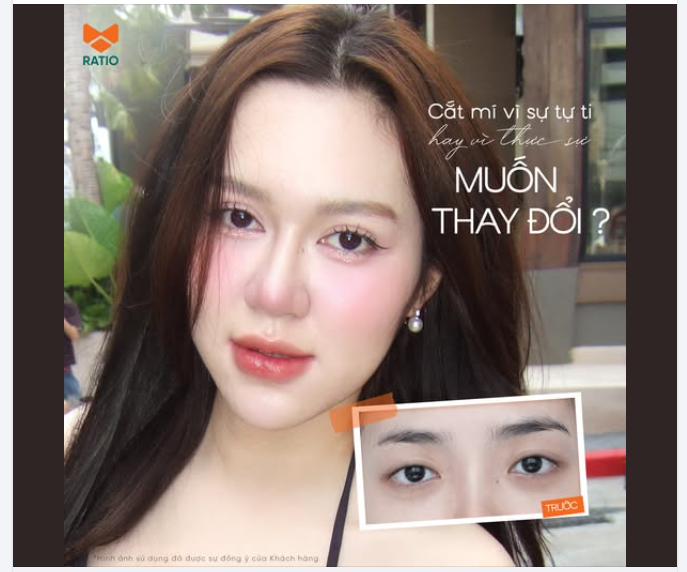 CẮT MÍ VÌ TỰ TI HAY THỰC SỰ MUỐN THAY ĐỔI?