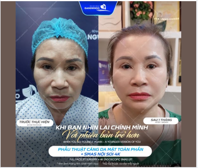 Có bao giờ bạn vô tình nhìn lại những bức ảnh cũ… và chợt nhận ra thời gian đã để lại dấu vết rõ ràng trên gương mặt mình?