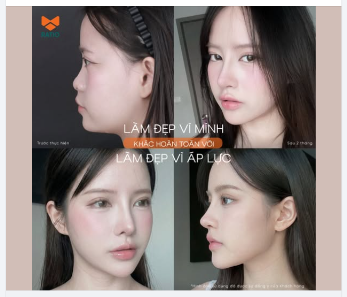 LÀM ĐẸP VÌ MÌNH KHÁC HOÀN TOÀN VỚI LÀM ĐẸP VÌ ÁP LỰC