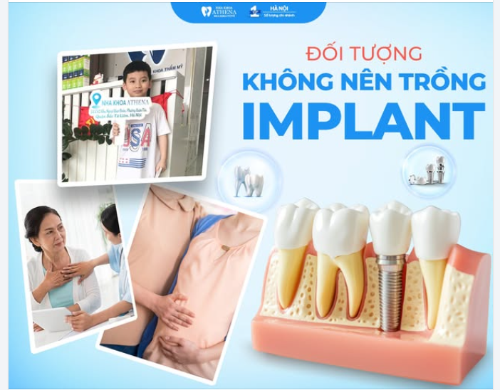 Không phải ai cũng trồng được Implant – Bạn có nằm trong số đó?