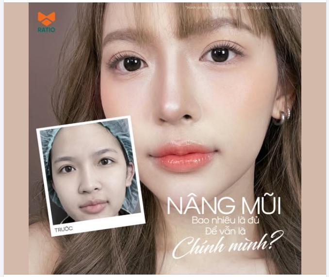 NÂNG MŨI BAO NHIÊU LÀ ĐỦ ĐỂ VẪN HỢP VỚI CHÍNH MÌNH?
