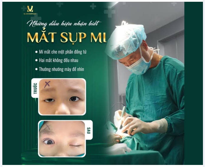 Sụp mi mắt – Đừng chủ quan với dấu hiệu tưởng chừng nhỏ