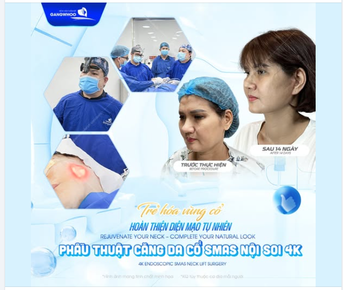 Phụ nữ chúng ta thường chăm chút rất kỹ cho da mặt, nhưng đôi khi lại bỏ quên "vùng da thanh xuân" thứ hai: Vùng Cổ.