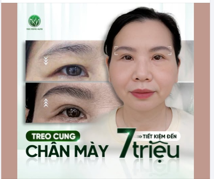 Đối tượng phù hợp để treo cung chân mày.
