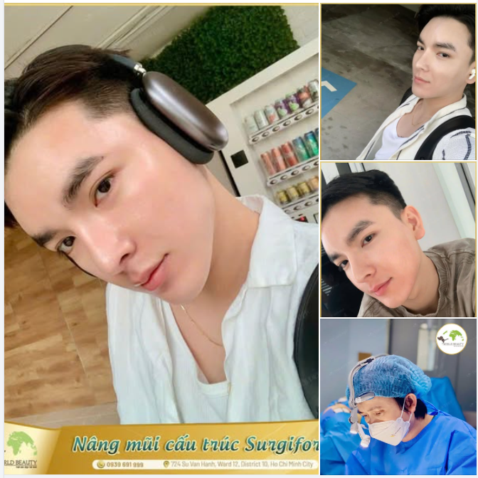 Hoàn thiện diện mạo nam tính – nâng tầm phong thái lịch lãm với giải pháp chỉnh hình cấu trúc mũi cá nhân hóa