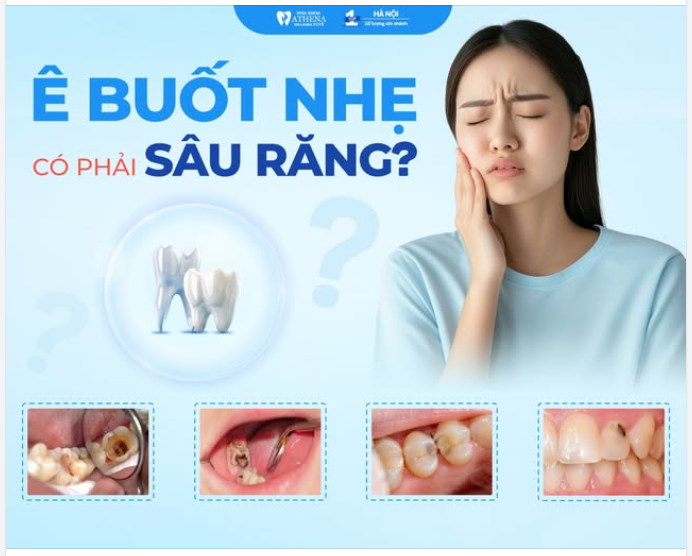 Ê BUỐT NHẸ CÓ PHẢI SÂU RĂNG KHÔNG?