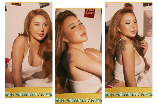 Cô nàng đón tuổi mới với thần thái cuốn hút cùng dáng mũi bền đẹp sau 2 năm thực hiện phương pháp nâng mũi cấu trúc!