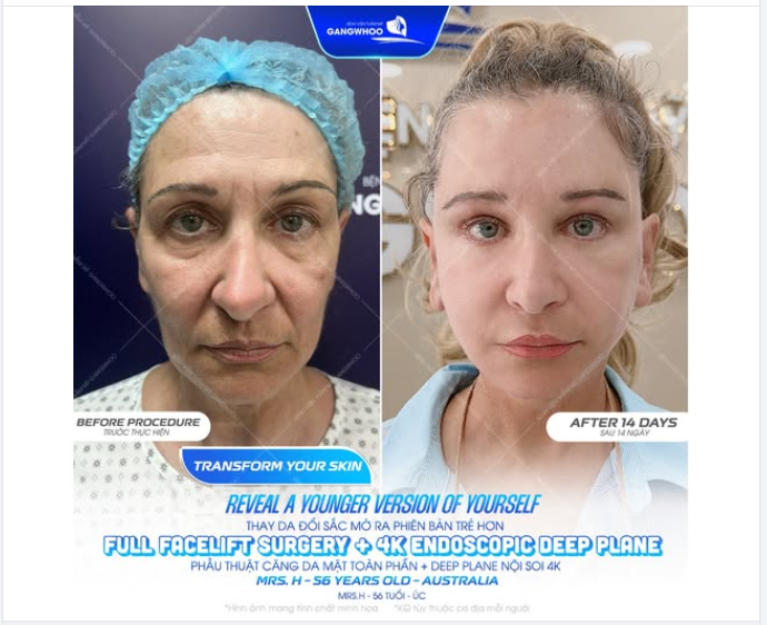 Có khi nào bạn cảm thấy gương mặt mình không còn phản chiếu đúng “tinh thần tuổi trẻ” bên trong?