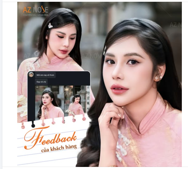 Cảm ơn Feedback từ chị T.H. sau 7 tháng nâng mũi