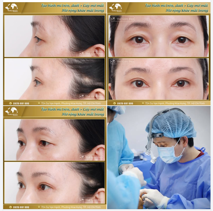 Đôi mắt không chỉ thể hiện cảm xúc, mà còn quyết định thần thái của cả gương mặt.