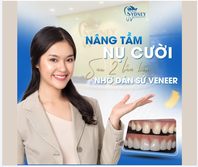 NÂNG TẦM NỤ CƯỜI CHỈ SAU 2 LẦN HẸN NHỜ DÁN SỨ VENEER