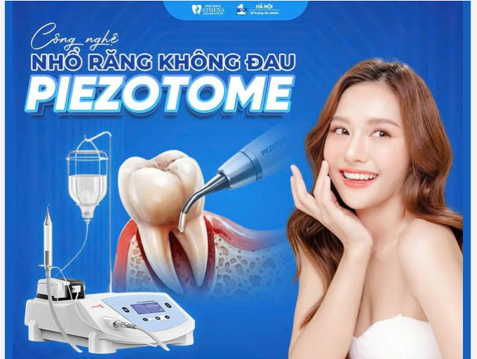 NHỔ RĂNG ÊM ÁI – PHỤC HỒI TỨC THÌ VỚI CÔNG NGHỆ PIEZOTOME