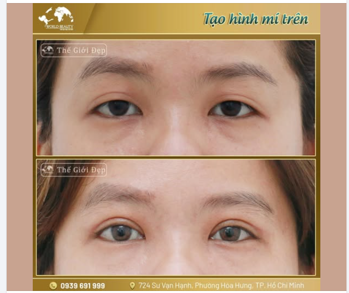 Ánh mắt thường là nơi người đối diện chú ý đầu tiên.